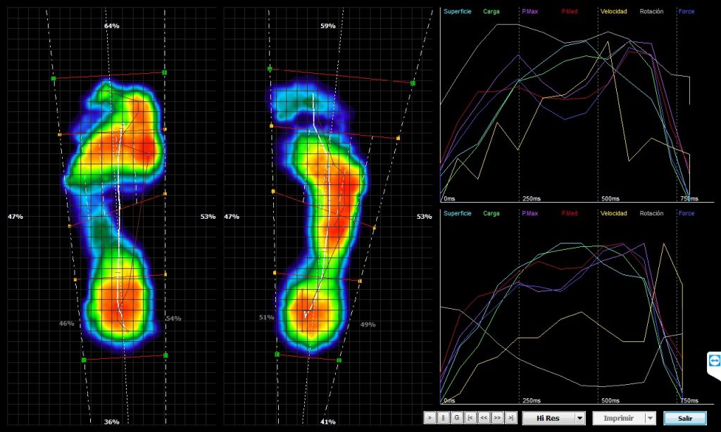 análisis dinámico