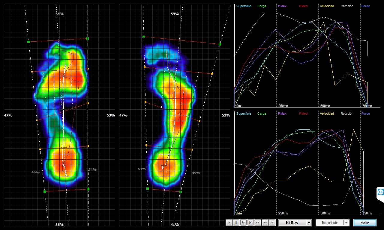 Biomecánica del movimiento humano análisis dinámico